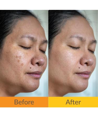 Yoove Turmeric & Kojic Acid Soap - Exfoliating Scrubber Natural Ingredients Clear Dark Spots & Acne Radiant Skin | 3-Pack - Buy Online on GoSupps.com