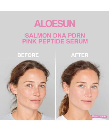 ALOESUN Salmon DNA PDRN Pink Peptide Niacinamide Face Serum - Korean Skin Care - Hydrating Moisturizing Firming Uneven Tone & Dark Spots - Collagen Support Complex - Lightweight Finish - 1.01 Fl Oz - Buy Online on GoSupps.com