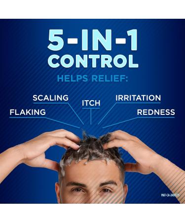 Selsun Blue Normal-Oily Hair Anti-Dandruff Shampoo 300mL Helps Control Dandruff Itching and Flaking 1% Selenium Sulfide Formula - Buy Online on GoSupps.com