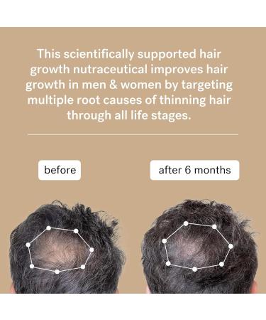 Haelf Hair Growth Nutraceutical (30 Days) Hair Growth Nutraceutical Capsules Daily treatment for Men & Women Specially developed and coordinated formula - Buy Online on GoSupps.com