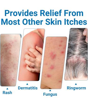 Extra Strength Anti Itch Cream - Portable Relief for Bug Bites Poison Ivy & Itchy Skin - with Oatmeal - 0.7oz - Buy Online on GoSupps.com