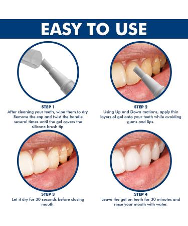 SmileWhite Teeth Whitening Pen (4 Pens) - Kit with Gel for Effective, Painless Results | Non-Sensitive, Travel-Friendly | Natural Mint Flavor - Buy Online on GoSupps.com