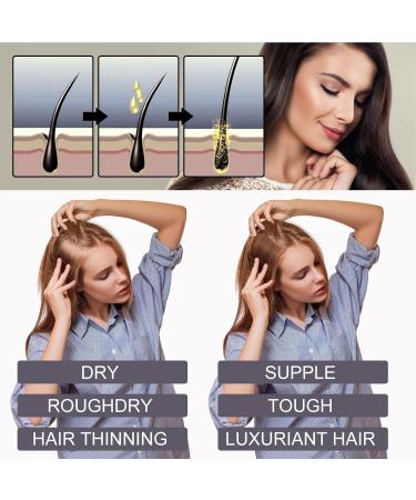 Aferzov Hair Oils for Hair Growth | Hair Lotion for Strong and Thick Hair - Biotin and Collagen for Natural Hair Growth Anti Hair Loss - Buy Online on GoSupps.com
