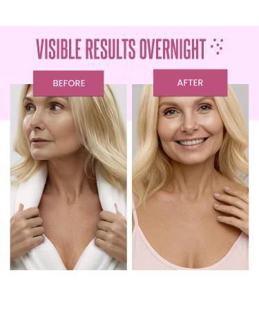 Cleverfy Silicone Chest Anti Wrinkle Patches for D collet - 3-Pack of T-Shape Reusable Wrinkle Pads 3-Pack T-Shape - Buy Online on GoSupps.com