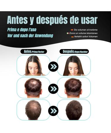 Mimoka Hair Scattering Powder - 100% Natural Microfibers for Men & Women - Light Brown - Conceals Bald Spots - 30g - Buy Online on GoSupps.com