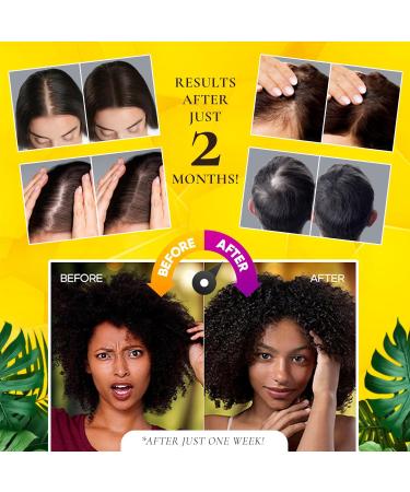 100% Cold-Pressed Unscented Batana Oil - Thicker Fuller Hair Fights Thinning & Promotes Growth | Hair & Scalp Superfood Rich in Vitamin E - Buy Online on GoSupps.com