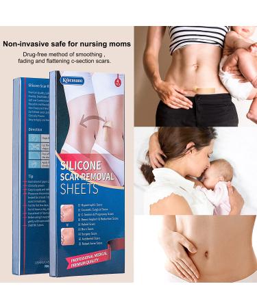 Krucasano Advanced Silicone Scar Sheets - 4 Reusable Sheets for Surgery, C-Section, Burn, Keloid, Acne, Old & New Scars - Hypertrophic Scar Removal - Buy Online on GoSupps.com