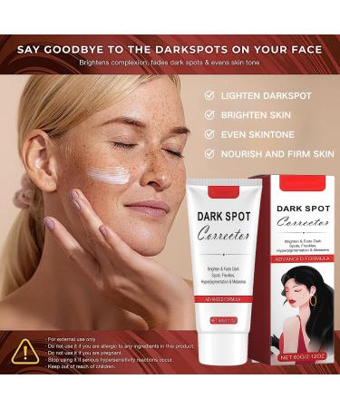Dark Spot Remover for Face and Body Freckle Removel Cream Pigmentation Removal Melasma Cream Dark Spot Corrector Dark Spot Remover for Face Age Spot Remover for Face Dark Age Spot Remover - Buy Online on GoSupps.com