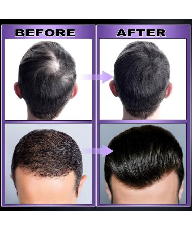 GIFBEA Organic Black Rice Water Hair Growth Serum Spray - Rosemary Scent Biotin & Castor Oil 5 Fl Oz - For All Hair Types - Hair Loss Treatment - Buy Online on GoSupps.com