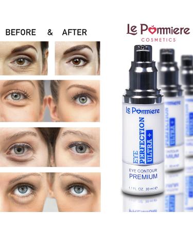 Le Pommiere Under Eye Cream 1.1 fl oz - Anti Bags, Dark Circles, Puffiness & Crow's Feet - Vitamin E Infused, Anti-Wrinkle Eye Contour Moisturizer for Face & Skin - Buy Online on GoSupps.com