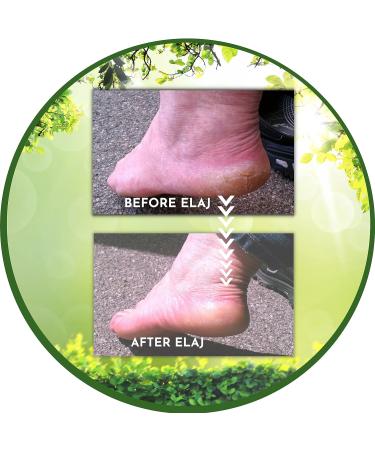 Elaj Pumice Stone Feet Scrubber - Natural Lava Rock Callus Remover for Soft Feet - Exfoliates Dry Skin, Promotes Foot Health - Women's Foot Care Tool - Buy Online on GoSupps.com