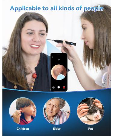 TopWigy Ear Wax Removal Tool with 1440P Camera, 6 LED Lights & 6 Spoons - Waterproof 5MP HD Ear Otoscope for iOS & Android - Black - Buy Online on GoSupps.com