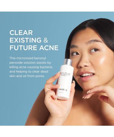 Jan Marini Skin Research Benzoyl Peroxide Acne Treatment Lotion 5% - 4 Oz | Effective Acne Solution International Shipping - Buy Online on GoSupps.com