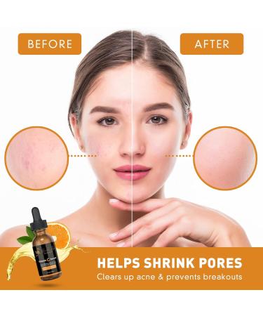 All Natural Facial Serum with Ferulic & Hyaluronic Acid - Vitamin C for Acne Scars & Dark Spots | ML Delicate Beauty - 30ml Face Serum for All Skin Types - Buy Online on GoSupps.com