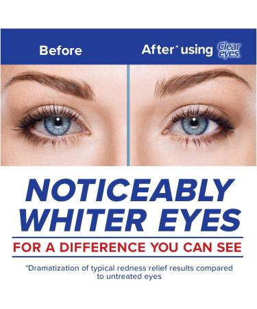 Clear Eyes Maximum Redness Relief Eye Drops - 0.5 Fl Oz (Pack of 3) | Fast Relief from Dryness Burning & Irritation - Max Strength Formula - Buy Online on GoSupps.com