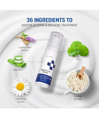 ABERA Seborrheic Dermatitis Cream Relief for Psoriasis & Eczema with Peptizinc + Herbal Complex Neurodermatitis Comfort Soothes Itching Face Scalp & Body Daily Relief Steroid Free (1.01 Fl Oz) 1 Box - Buy Online on GoSupps.com