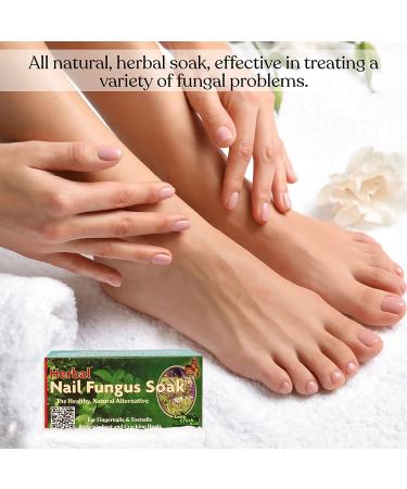 Nail Fungus Soak - Natural Solution for Toenail and Fingernail Issues - Combat Cracked Heels and Athlete's Foot - Hypoallergenic Fungus Remover for Feet and Hands - Buy Online on GoSupps.com