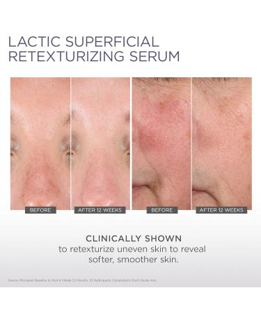 Glytone Micro-Peel Lactic Serum 10% - Vegan & Fragrance-Free Retexturizer for Dull Dry Skin - International Shipping Available - Buy Online on GoSupps.com
