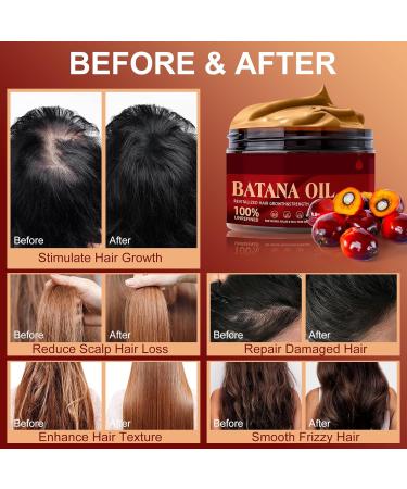 Unrefined Batana Oil for Hair Growth | Organic Nourishing Moisturizer | Repair Damaged Hair & Prevent Hair Loss | 4.0 Fl. Oz - Buy Online on GoSupps.com