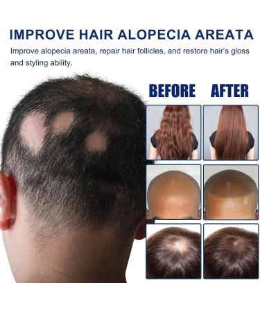 Hair care set Hair Oil Reduce Hair Loss - Buy Online on GoSupps.com