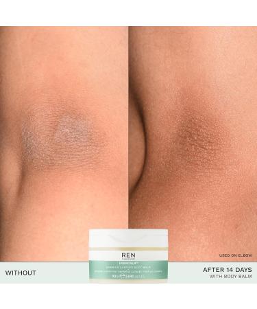 REN Clean Skincare Evercalm Barrier Support Body Balm - Nourishing Balm for Sensitive Dry & Eczema-Prone Skin - 3.04 fl oz - International Shipping - Buy Online on GoSupps.com