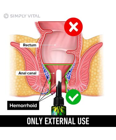 Hemorrhoid Treatment Cream Gel | Fast-Acting Pain Relief | Made in USA | 5% Lidocaine | Heal Fissures - Buy Online on GoSupps.com