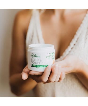 Wild Naturals Eczema Psoriasis Cream 4 oz - Natural 15-in-1 Lotion for Dry Irritated Skin - Soothes, Moisturizes, Reduces Redness - Steroid-Free for Adults, Kids, Baby - Buy Online on GoSupps.com