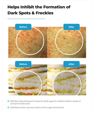 Probiotic Serum (Season 4) - Hydrates Boosts Elasticity & Reduces Pores in 3 Days | Korean Skincare eCommerce - Buy Online on GoSupps.com