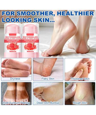  MrCuvaryas 2025 Set of 2 moisturizing and anti-crack foot creams - 60% urea - Cream for very dry feet - For calluses - Body lotion with acid - Moisturizing hand cream - Buy Online on GoSupps.com