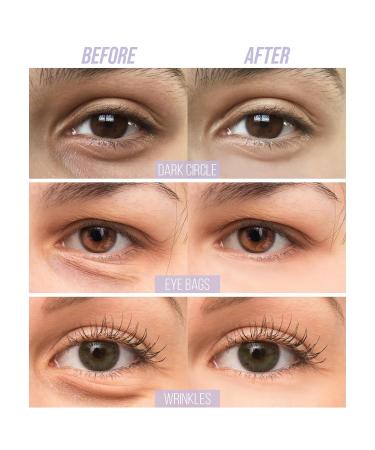 Under Eye Patches - 30 Pairs of Caffeine Eye Masks for Dark Circles Puffiness & Wrinkles | Hydrating Eye Gel Pads for Brightening & Skincare - Buy Online on GoSupps.com