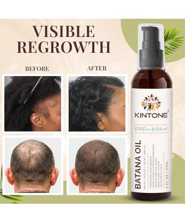 Batana Oil for Hair Growth with Pump 100% Pure Raw Cold-Pressed from Dr. Sebi Honduras Natural Hair Oil Nourishes Strengthens Repairs Thickens Hair and Scalp 4 fl oz - Buy Online on GoSupps.com