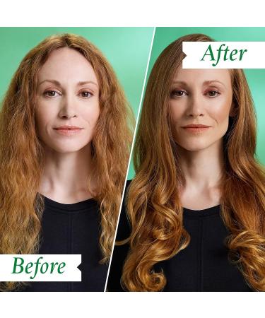 PHILIP KINGSLEY Flaky Scalp Shampoo - Cleansing Scalp Care for Dry, Oily Scalps - Soothes and Calms - 8.45 Fl Oz - Buy Online on GoSupps.com