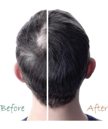 Organic Hair Energizer Hair Growth 4 Piece Set with Pro Vitamin-B5, DHT-Blockers & Ph-Balancing - Men, Women, Teens - Buy Online on GoSupps.com