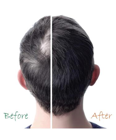 Organic Hair Growth Booster with Pro Vitamin-B5 6 fl oz - DHT-Blocker, Sulfate & Paraben-Free - For Thinning & Receding Hair - Color Safe - Men & Women - OHE01 - Buy Online on GoSupps.com