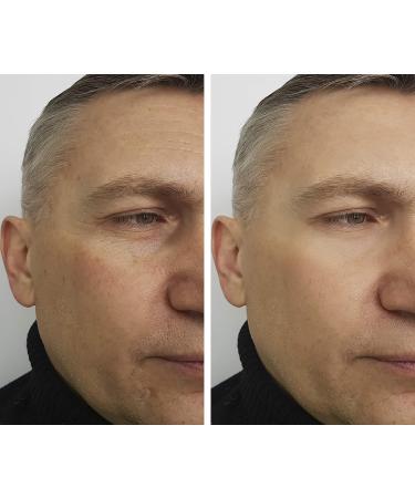 Ultimate Men's Skin Care Set | Anti-Aging Facial Cream Serum & Lotion | Argan Oil | Free Shipping Worldwide - Buy Online on GoSupps.com