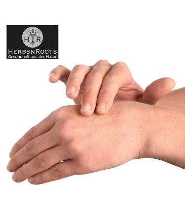 Lichen Dermatitis Cream with Swedish Herbs - Cortisone-Free Relief | HerbsnRoots 100ml - Buy Online on GoSupps.com