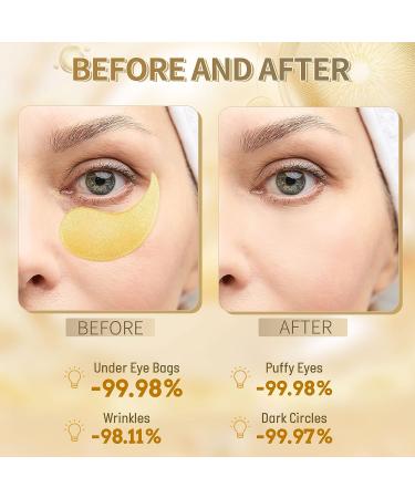 Hicream 24k Gold Under Eye Patches - 60 Pcs Anti-Aging Collagen & Hyaluronic Acid Eye Masks for Dark Circles, Puffiness & Wrinkles - Buy Online on GoSupps.com