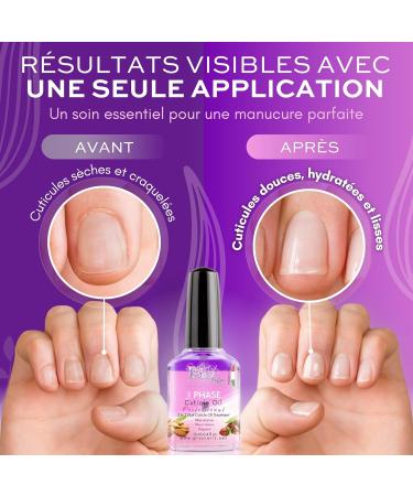 Emollient Nail Cuticle Oil 12 ml - Nail care with blackcurrant almond jojoba and flax oil - Regenerating and moisturizing water for damaged dry and irritated cuticles - Buy Online on GoSupps.com