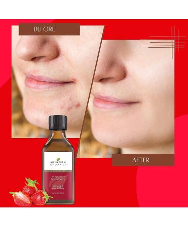 Strawberry Seed Oil - 100% Natural Cold Pressed Carrier Oil for Skin, Hair, Face, Lip, and Nails Care - Aromatherapy & Massage Oil - Essential Oil for Yoga, Sleep, Diffuser - 3.4 Oz - Buy Online on GoSupps.com