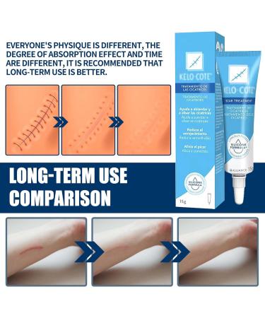 Scar Ointment 15g - Reduces Visibility of Scars | Effective Scar Gel & Cream for Faster Healing - Buy Online on GoSupps.com