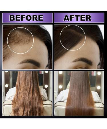 GIFBEA Organic Black Rice Water Hair Growth Serum Spray - Rosemary Scent Biotin & Castor Oil 5 Fl Oz - For All Hair Types - Hair Loss Treatment - Buy Online on GoSupps.com