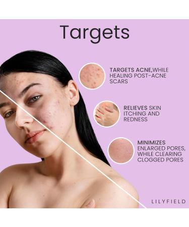 LILYFIELD Luminous Glow Serum - 10% Niacinamide for Acne Pigmentation & Enlarged Pores | Brightening Korean Skincare for Sensitive Skin - 30ml - Buy Online on GoSupps.com