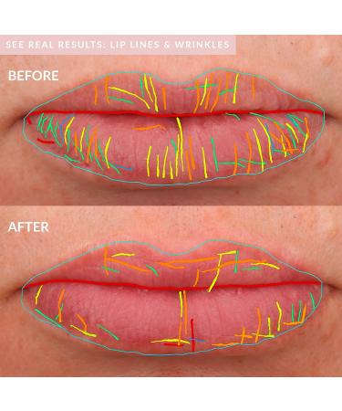 Buy PMD Kiss Lip Plumping System in Blush | Enhance Your Lips | International Shipping Available - Buy Online on GoSupps.com