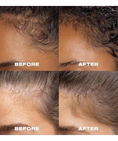 XMONDO Hair A3 Complex Scalp Foam for Hair Density | Vegan Formula with Biollagen & Amaranth Fast-Acting Plant Actives For Amplified Volume & Visibly Fuller Healthier-Looking Hair 3.38 Fl Oz - Buy Online on GoSupps.com