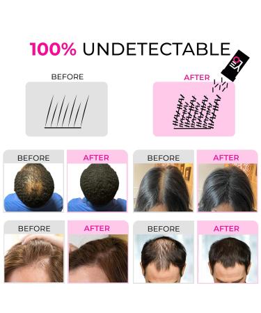 VELO Hair Building Fibers for Thinning Hair - Dark Brown 30g | Instant Volume & Fuller Look for Men & Women - Conceals Hair Loss Long Lasting Solution - Buy Online on GoSupps.com