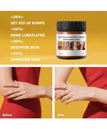 Dark Knuckle Remover Underarm Cream Body Moisturizer Lotion Toe Knuckles Removal Remover Corrector for Armpit Knees Elbow Inner Thigh Neck Private Part Intimate Skin Cream 4.21floz/120g - Buy Online on GoSupps.com