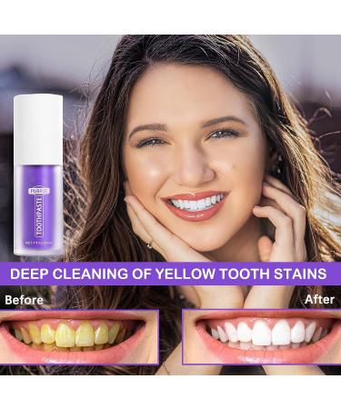 Purple Teeth Whitening Toothpaste for Sensitive Teeth - Intensive Stain Removal and Deep Cleansing - Buy Online on GoSupps.com
