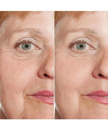 3PCS:MSGBcg Ageless Rejuvenate Face Serum Instant Face Lift & Anti Wrinkle Firming Serum for Reduce Wrinkles - Fine Lines - Plumping Skin 12% Vitamin c + 1% Hyaluronic Acid Formula for All Skin Types - Buy Online on GoSupps.com