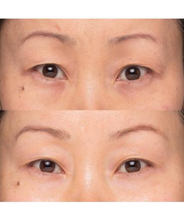 Instant Effects Eye Lift Serum: Repair, Smooth, and Moisturize - Diminish Dark Circles and Puffiness - Brighten, Lift, and Nourish - 0.27 Oz - Buy Online on GoSupps.com