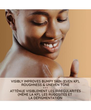 Aveeno Tone and Texture Daily Renewing Lotion Fragrance-Free Dry Skin & Keratosis Pilaris Oat Extract Vitamin B3 532-mL & Overnight Cream 227 g Lotion + Overnight Cream 227 g - Buy Online on GoSupps.com